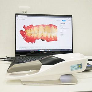 光学3Dスキャナー